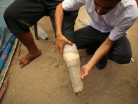 Muattaz Abu Dayeh, a physiotherapist, is applying a medical prosthesis to 32-year-old worker Majd al-Omari, who lost part of his leg during...