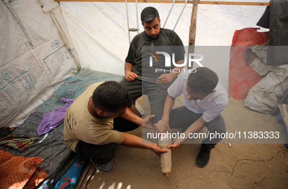 Muattaz Abu Dayeh, a physiotherapist, is applying a medical prosthesis to 32-year-old worker Majd al-Omari, who lost part of his leg during...