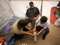 Muattaz Abu Dayeh, a physiotherapist, is applying a medical prosthesis to 32-year-old worker Majd al-Omari, who lost part of his leg during...