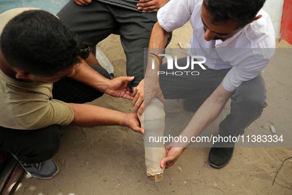 Muattaz Abu Dayeh, a physiotherapist, is applying a medical prosthesis to 32-year-old worker Majd al-Omari, who lost part of his leg during...