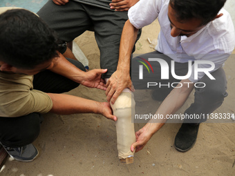 Muattaz Abu Dayeh, a physiotherapist, is applying a medical prosthesis to 32-year-old worker Majd al-Omari, who lost part of his leg during...