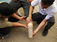 Muattaz Abu Dayeh, a physiotherapist, is applying a medical prosthesis to 32-year-old worker Majd al-Omari, who lost part of his leg during...