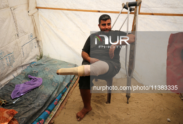 Muattaz Abu Dayeh, a physiotherapist, is applying a medical prosthesis to 32-year-old worker Majd al-Omari, who lost part of his leg during...