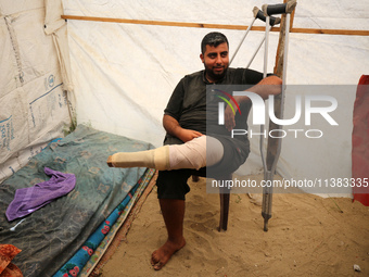 Muattaz Abu Dayeh, a physiotherapist, is applying a medical prosthesis to 32-year-old worker Majd al-Omari, who lost part of his leg during...