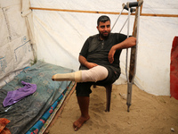 Muattaz Abu Dayeh, a physiotherapist, is applying a medical prosthesis to 32-year-old worker Majd al-Omari, who lost part of his leg during...