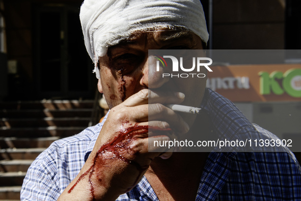 An injured man with blood on his face and hands is smoking after a Russian missile strike in Kyiv, Ukraine, on July 08, 2024, amid the Russi...