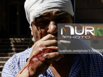 An injured man with blood on his face and hands is smoking after a Russian missile strike in Kyiv, Ukraine, on July 08, 2024, amid the Russi...