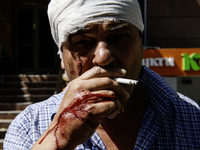 An injured man with blood on his face and hands is smoking after a Russian missile strike in Kyiv, Ukraine, on July 08, 2024, amid the Russi...