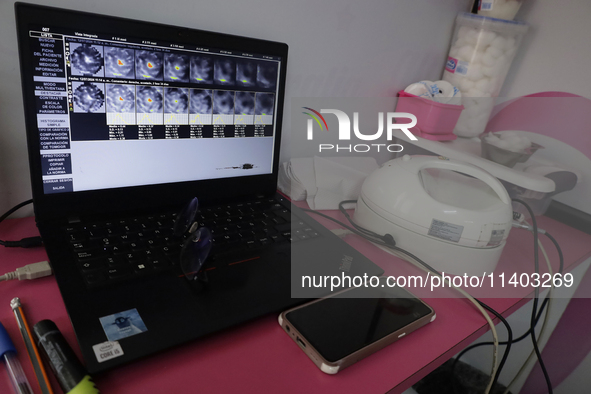 A laptop and a mastograph are being used in a mobile unit with two clinics in Mexico City, Mexico, as part of the free mastography studies o...