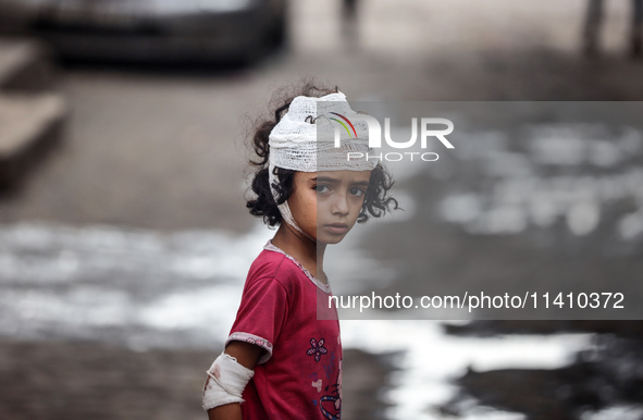 An injured girl is standing at a school run by the UN Relief and Works Agency for Palestine Refugees (UNRWA) that was previously hit by Isra...