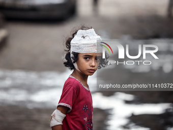 An injured girl is standing at a school run by the UN Relief and Works Agency for Palestine Refugees (UNRWA) that was previously hit by Isra...