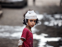 An injured girl is standing at a school run by the UN Relief and Works Agency for Palestine Refugees (UNRWA) that was previously hit by Isra...