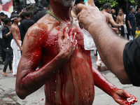 A volunteer is sprinkling rose water on the wounds of a Shi'ite Muslim after he flagellates himself during a Muharram procession marking Ash...