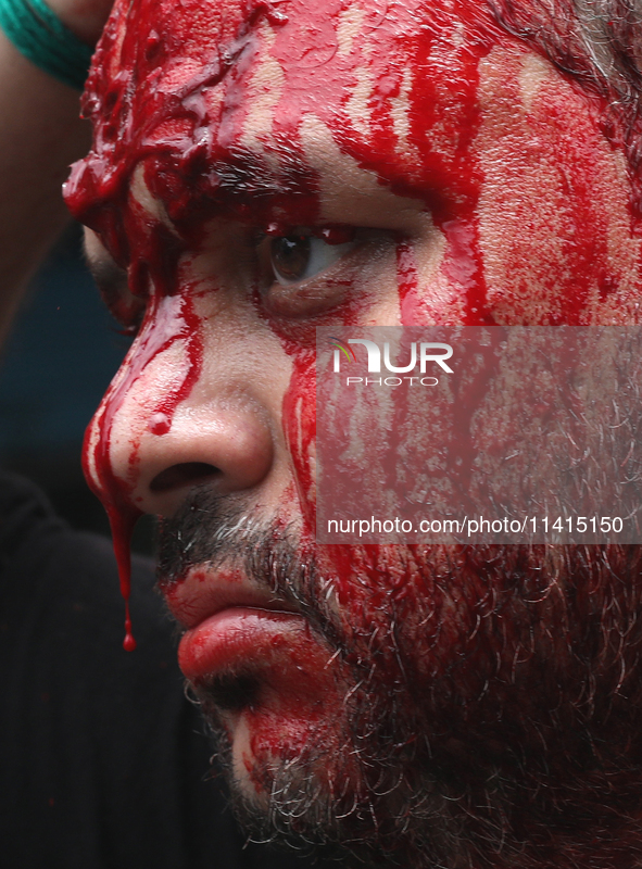 Blood is dripping from the nose of a Shi'ite Muslim man after flagellating himself during a Muharram procession marking Ashura, in Kolkata,...