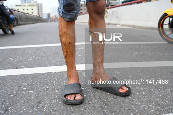 Students are clashing with the police during an ongoing anti-quota protest in Dhaka, Bangladesh, on July 18, 2024. 