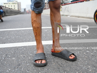 Students are clashing with the police during an ongoing anti-quota protest in Dhaka, Bangladesh, on July 18, 2024. (