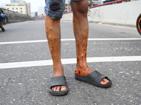 Students are clashing with the police during an ongoing anti-quota protest in Dhaka, Bangladesh, on July 18, 2024. (