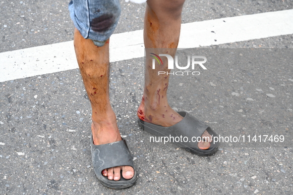 Students are clashing with the police during an ongoing anti-quota protest in Dhaka, Bangladesh, on July 18, 2024. 