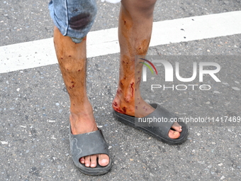 Students are clashing with the police during an ongoing anti-quota protest in Dhaka, Bangladesh, on July 18, 2024. (