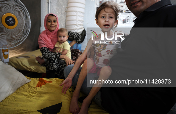 A doctor is holding Jana Ayad, a malnourished Palestinian girl, as she is receiving treatment at the International Medical Corps field hospi...