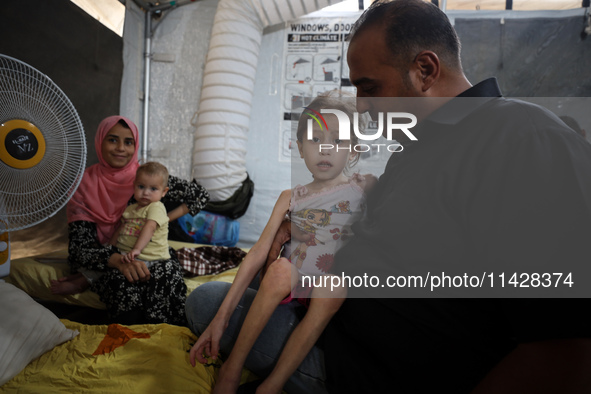 A doctor is holding Jana Ayad, a malnourished Palestinian girl, as she is receiving treatment at the International Medical Corps field hospi...