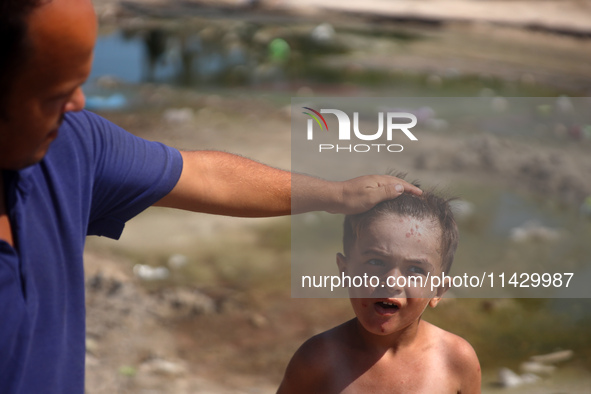 A Palestinian boy is suffering from a skin rash and standing past a pool of sewage water on a street in Deir el-Balah in the central Gaza St...