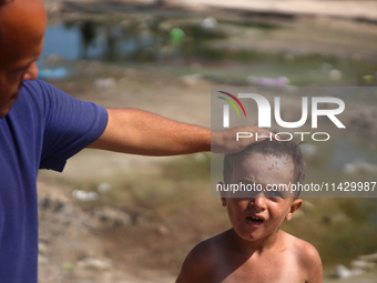 A Palestinian boy is suffering from a skin rash and standing past a pool of sewage water on a street in Deir el-Balah in the central Gaza St...