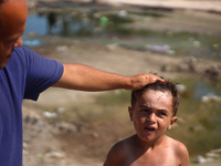 A Palestinian boy is suffering from a skin rash and standing past a pool of sewage water on a street in Deir el-Balah in the central Gaza St...