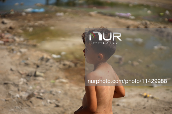 A Palestinian boy is suffering from a skin rash and standing past a pool of sewage water on a street in Deir el-Balah in the central Gaza St...