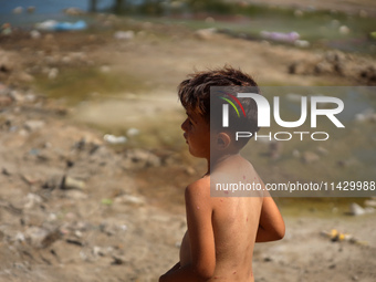 A Palestinian boy is suffering from a skin rash and standing past a pool of sewage water on a street in Deir el-Balah in the central Gaza St...