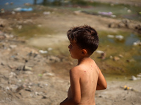 A Palestinian boy is suffering from a skin rash and standing past a pool of sewage water on a street in Deir el-Balah in the central Gaza St...