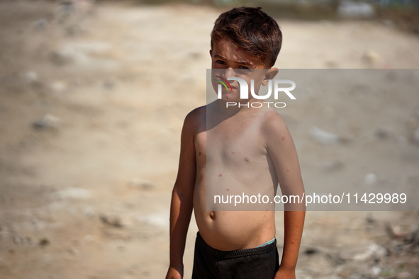 A Palestinian boy is suffering from a skin rash and standing past a pool of sewage water on a street in Deir el-Balah in the central Gaza St...