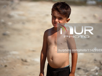 A Palestinian boy is suffering from a skin rash and standing past a pool of sewage water on a street in Deir el-Balah in the central Gaza St...