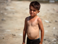 A Palestinian boy is suffering from a skin rash and standing past a pool of sewage water on a street in Deir el-Balah in the central Gaza St...