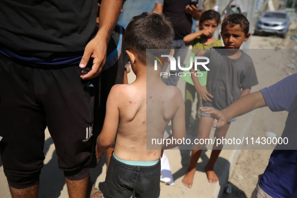 A Palestinian boy is suffering from a skin rash and is standing past a pool of sewage water on a street in Deir el-Balah in the central Gaza...