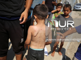 A Palestinian boy is suffering from a skin rash and is standing past a pool of sewage water on a street in Deir el-Balah in the central Gaza...