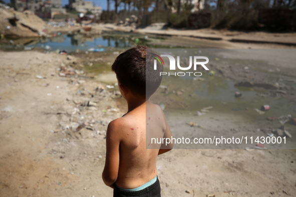 A Palestinian boy is suffering from a skin rash and is standing past a pool of sewage water on a street in Deir el-Balah in the central Gaza...