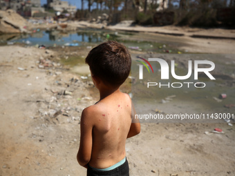 A Palestinian boy is suffering from a skin rash and is standing past a pool of sewage water on a street in Deir el-Balah in the central Gaza...