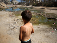 A Palestinian boy is suffering from a skin rash and is standing past a pool of sewage water on a street in Deir el-Balah in the central Gaza...