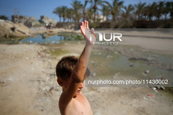 A Palestinian boy is suffering from a skin rash and is standing past a pool of sewage water on a street in Deir el-Balah in the central Gaza...