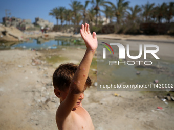 A Palestinian boy is suffering from a skin rash and is standing past a pool of sewage water on a street in Deir el-Balah in the central Gaza...