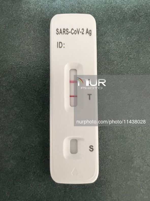 A positive COVID-19 rapid test is being shown at a doctor's office in Toronto, Ontario, Canada, on July 23, 2024. COVID-19 numbers are spiki...