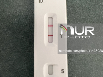 A positive COVID-19 rapid test is being shown at a doctor's office in Toronto, Ontario, Canada, on July 23, 2024. COVID-19 numbers are spiki...