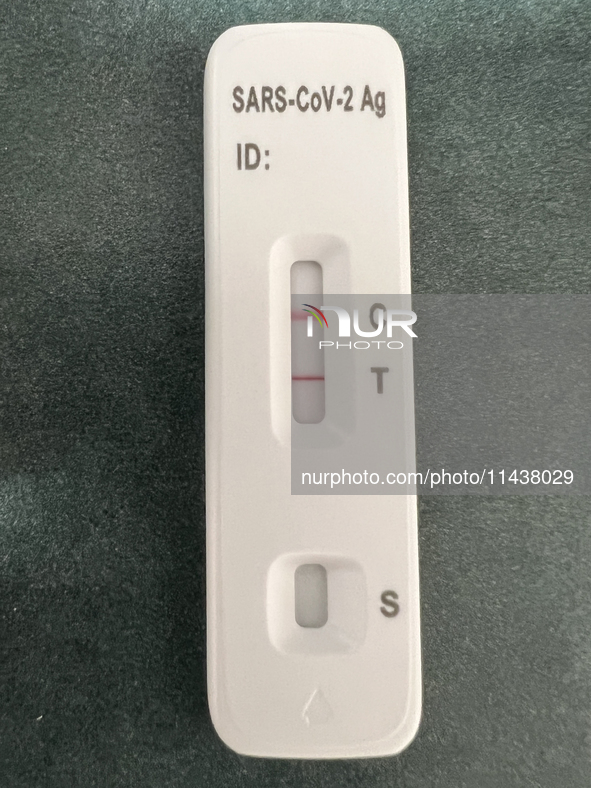 A positive COVID-19 rapid test is being shown at a doctor's office in Toronto, Ontario, Canada, on July 23, 2024. COVID-19 numbers are spiki...