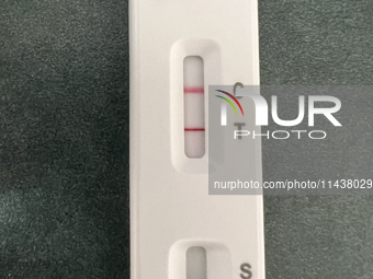 A positive COVID-19 rapid test is being shown at a doctor's office in Toronto, Ontario, Canada, on July 23, 2024. COVID-19 numbers are spiki...