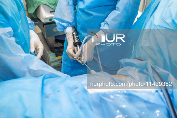 A doctor is performing laparoscopic lithotomy on a patient at the Second People's Hospital of Jinsha County in Bijie, China, on July 17, 202...