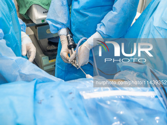 A doctor is performing laparoscopic lithotomy on a patient at the Second People's Hospital of Jinsha County in Bijie, China, on July 17, 202...