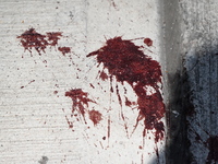 Blood is on the sidewalk outside of the Tremont Av station. Two men are being slashed outside of the Tremont Avenue subway station in Bronx,...