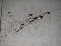 Blood is on the sidewalk outside of the Tremont Av station. Two men are being slashed outside of the Tremont Avenue subway station in Bronx,...