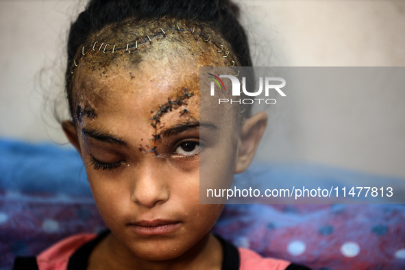 The Palestinian child Sila Houso, 7 years old, is being displaced from Gaza City to the central Gaza Strip. She is being injured during an I...